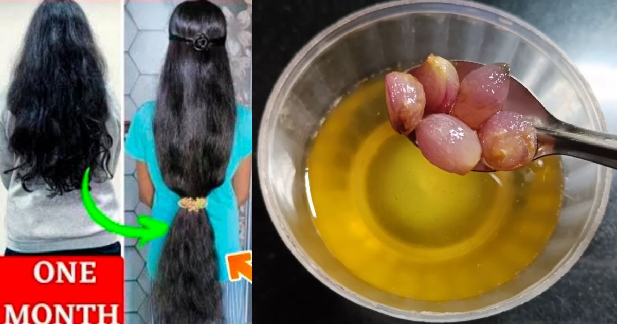 Tips To Natural Hair growth oil using onion